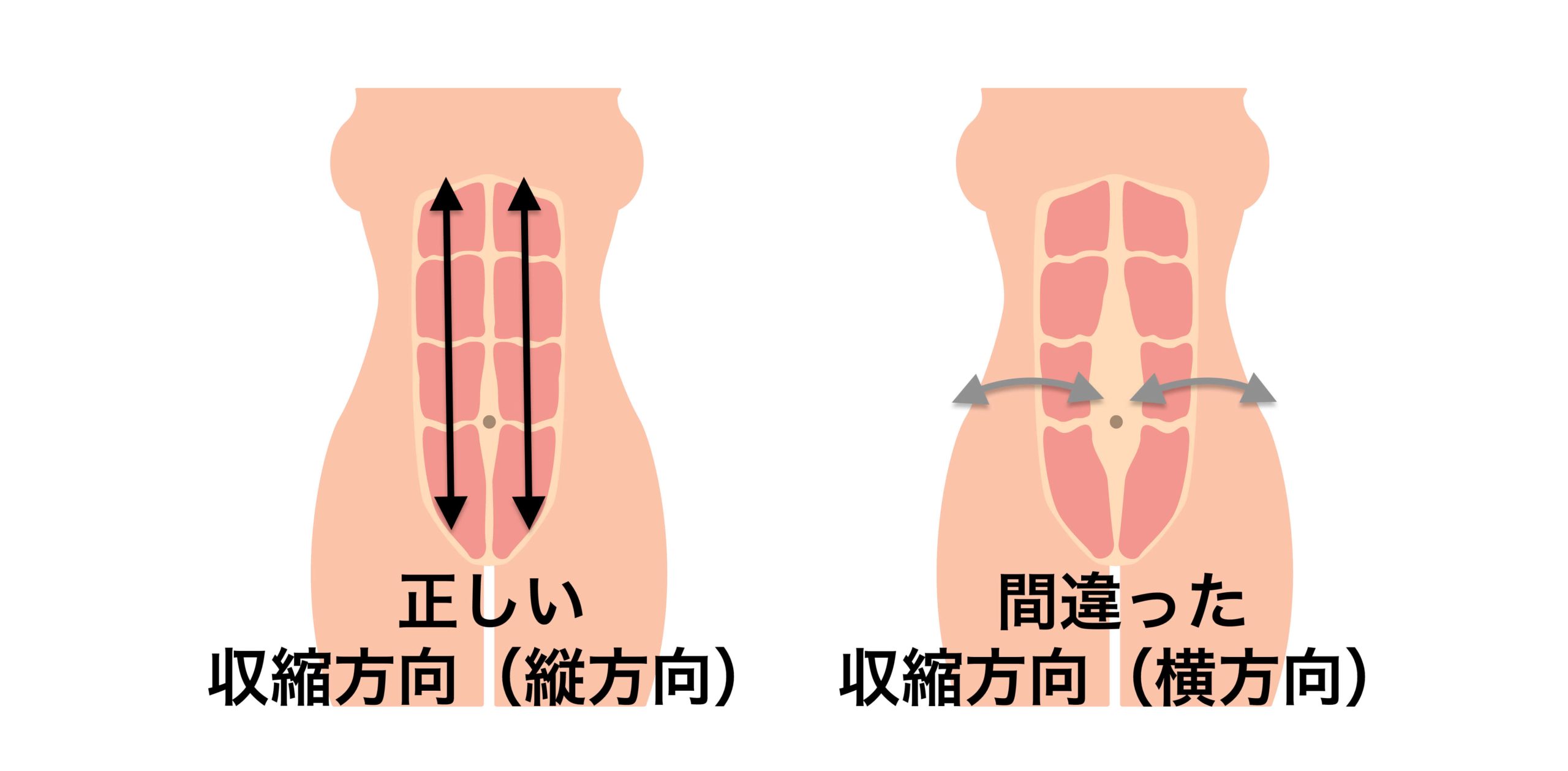 腹直筋の収縮方向
