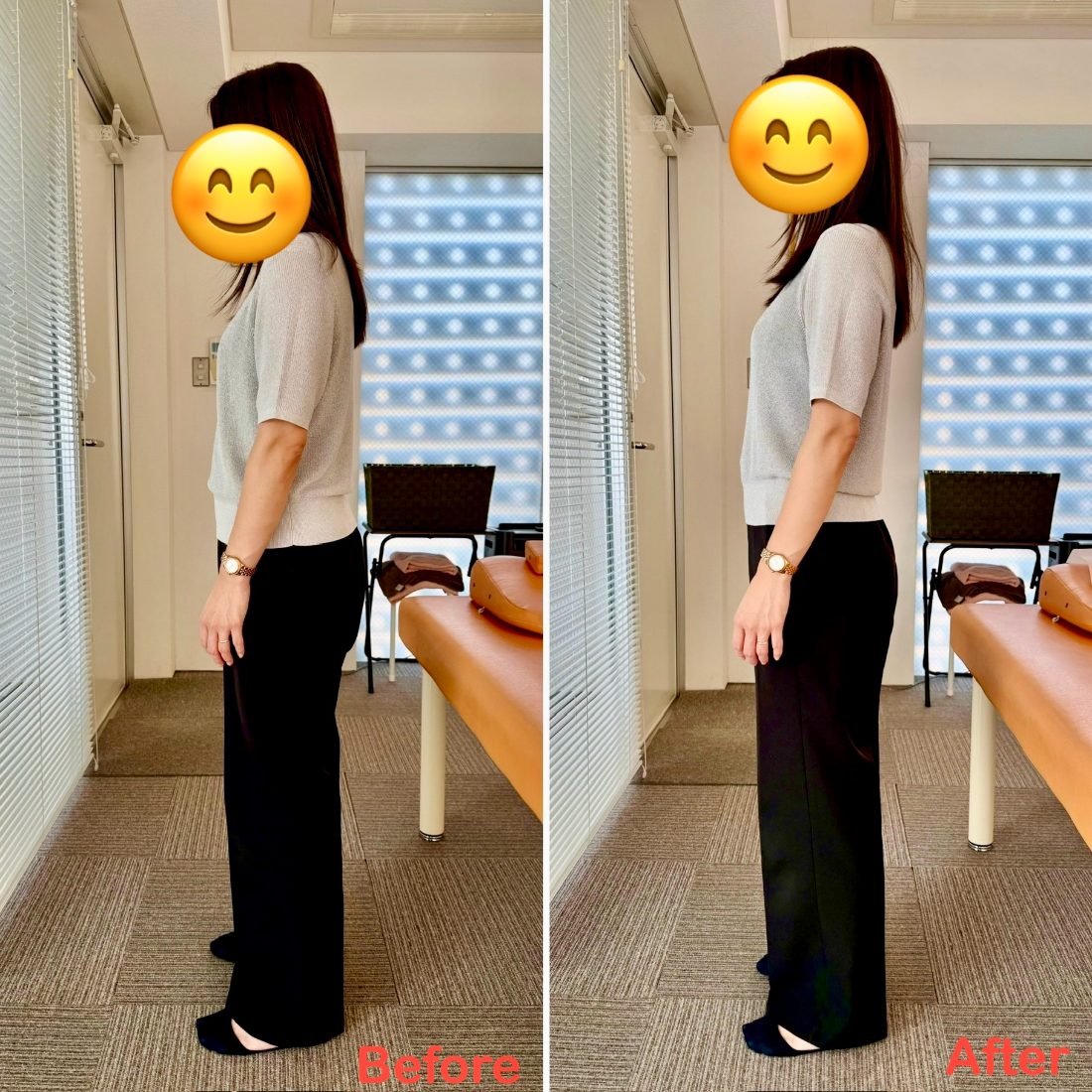 施術前後の姿勢の変化（ビフォーアフター）